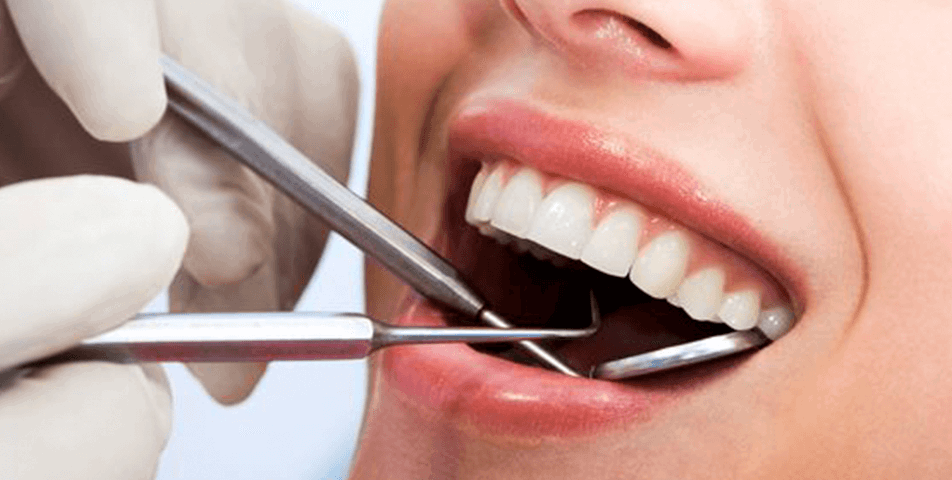 teeth dying enhancements